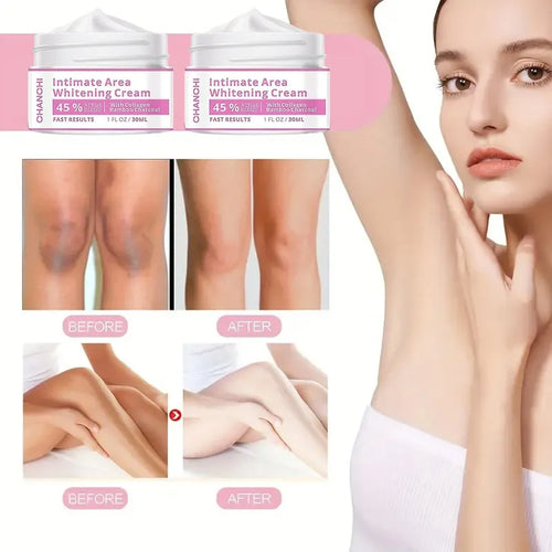 Skin Brightening Cream for Men & Women Dark Spot Corrector for Even Skin Tone & Hydrating & Smoothing Formula for Face, Inner Thighs & Body – Daily Use Moisturizing Cream 30ML